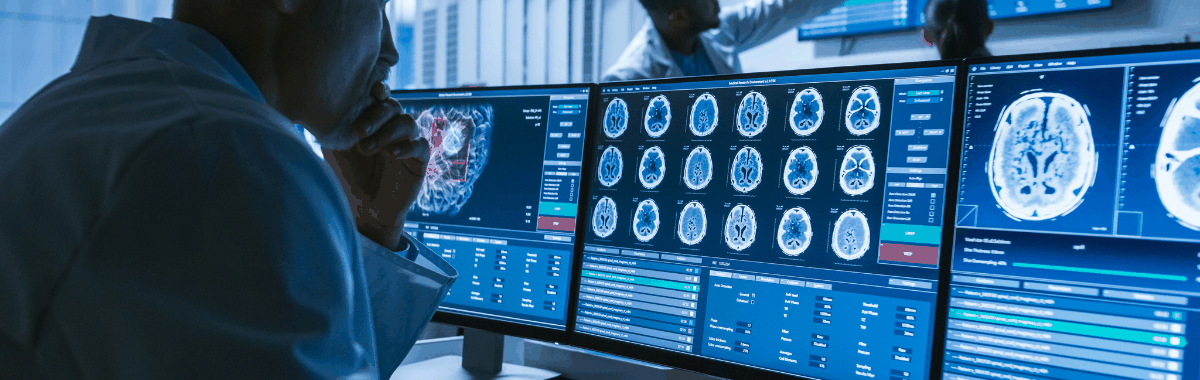 Gut-brain axis research