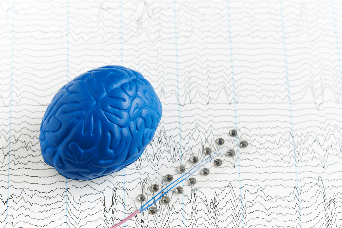 Illustration accompanying section on EEG brain wave findings